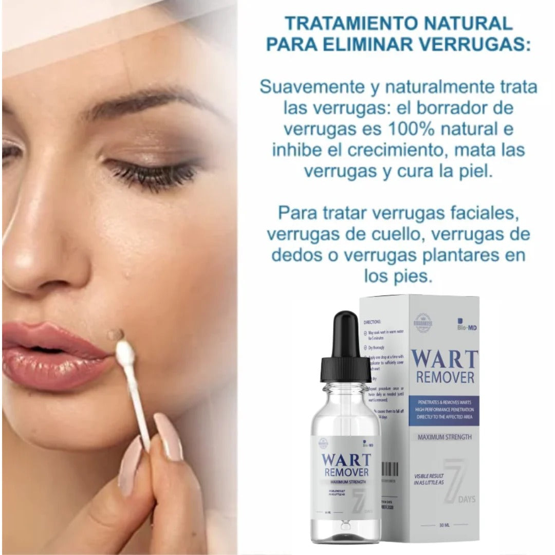 WART REMOVER | REMOVEDOR DE VERRUGAS Y LUNARES